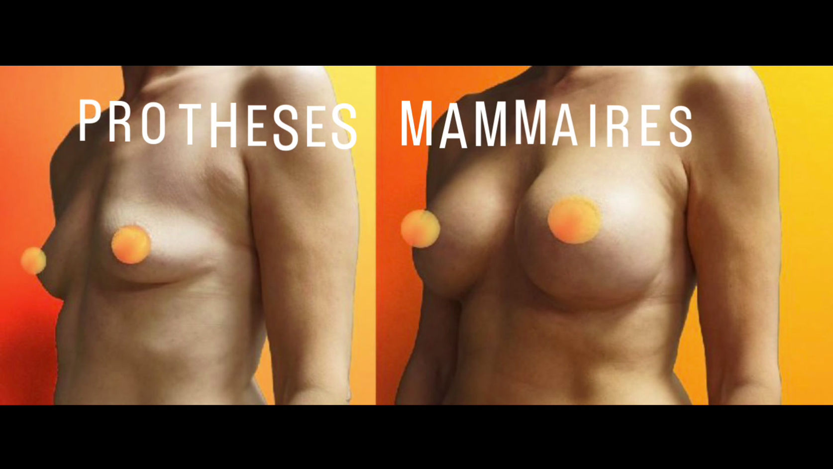 Toutes les vidéos
